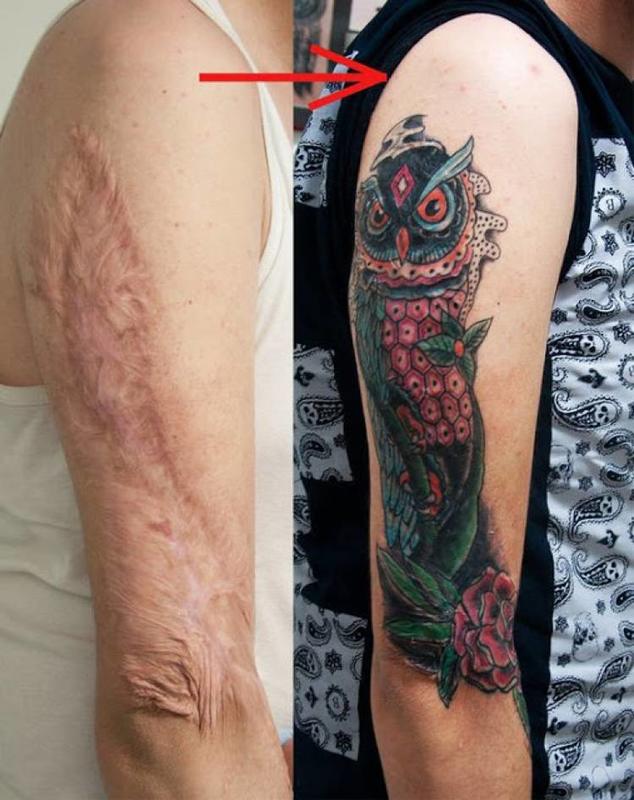 15 Photos Of Domestic Abuse Scars Turned Into Breathtaking Art