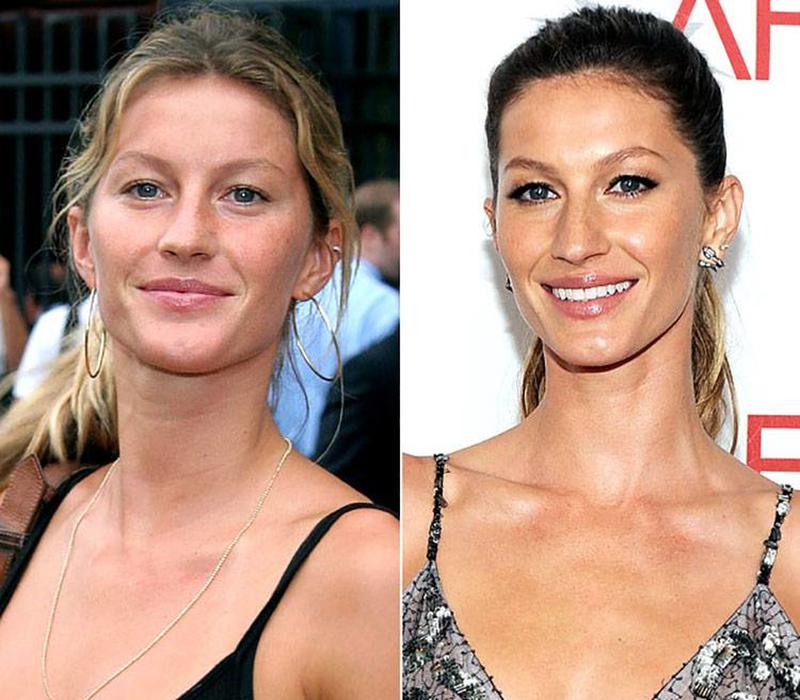 50 Photos Of Celebrities Without Makeup
