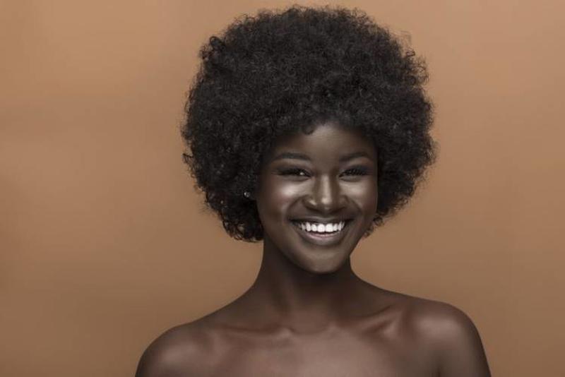 Teen Bullied For Her Incredibly Dark Skin Color Ends Up Becoming A Gorgeous Model